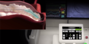 csm_csm_N_Siem_Heal_UEbernahme_skaliert_ce8193c791_f84ce55a4c